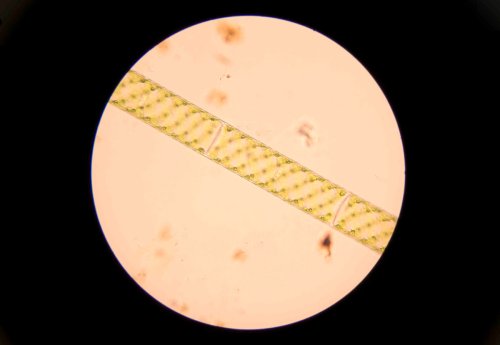 Algas micrscópicas en una gota  de água de una charca